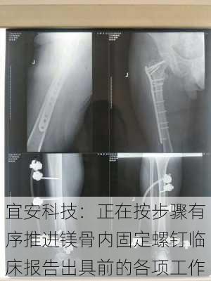 宜安科技：正在按步骤有序推进镁骨内固定螺钉临床报告出具前的各项工作